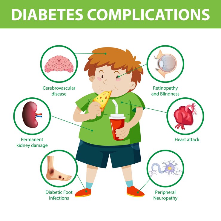 Diabetes Complications
