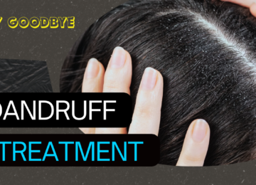 Effective Dandruff Treatment