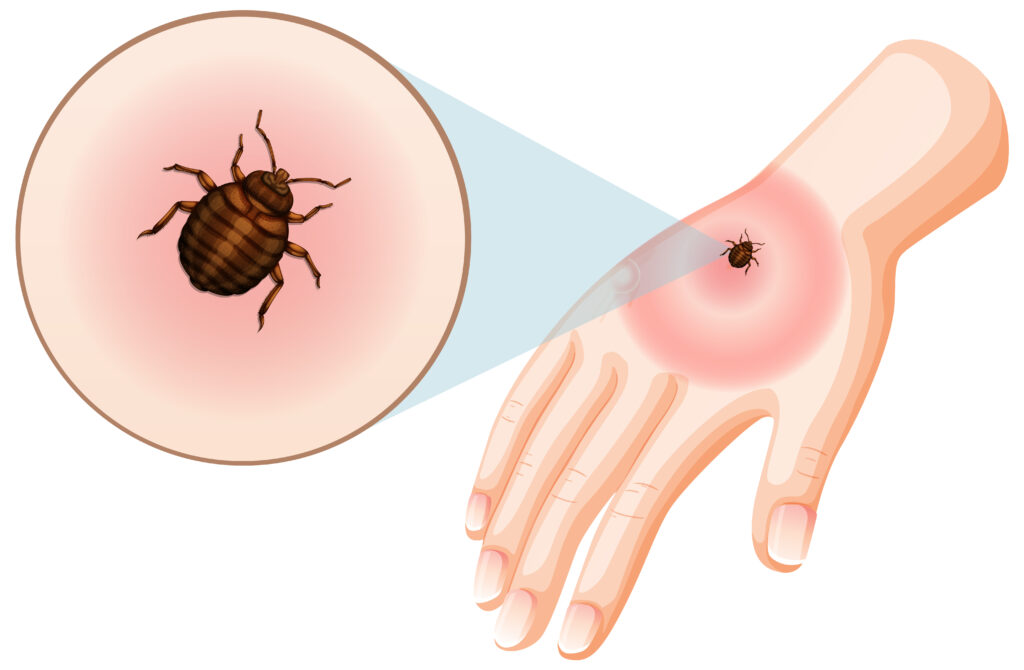 Tick Bites and Prevention