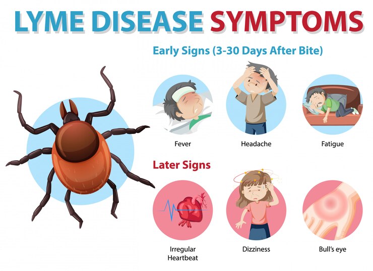 Early Symptoms of Lyme Disease