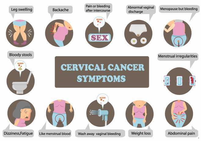 cervical cancer Symptoms